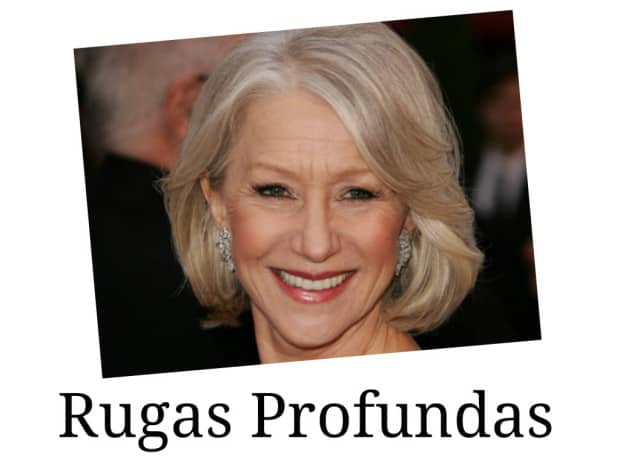 rugas profundas